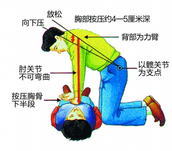 最新心肺复苏步骤指南，拯救生命的正确操作